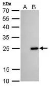 Anti-Bcl-2 antibody [GT11210] used in Western Blot (WB). GTX628905
