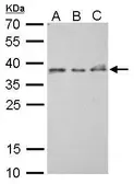 Anti-ZWINT antibody [GT276] used in Western Blot (WB). GTX628915