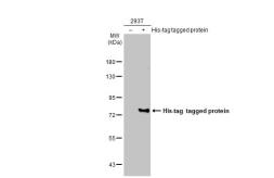 Anti-6X His tag antibody [GT161] used in Western Blot (WB). GTX628921