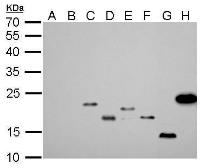 Anti-6X His tag antibody [GT161] used in Western Blot (WB). GTX628921
