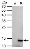 Anti-6X His tag antibody [GT161] used in Western Blot (WB). GTX628921