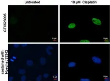 Anti-Histone H2A.XS139ph (phospho Ser139) antibody [GT1021] used in Immunocytochemistry/ Immunofluorescence (ICC/IF). GTX628996