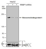 Anti-Ribosome binding protein 1 antibody [GT1611] used in Western Blot (WB). GTX628997
