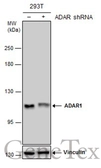 Anti-ADAR1 antibody [GT1066] used in Western Blot (WB). GTX629000
