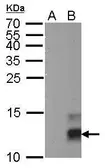 Anti-Pancreatic Polypeptide antibody [GT327] used in Western Blot (WB). GTX629070
