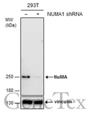Anti-NuMA antibody [GT1510] used in Western Blot (WB). GTX629072