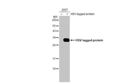 Anti-HSV tag antibody [GT223] used in Western Blot (WB). GTX629073