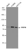 Anti-PAF49 antibody [GT635] used in Western Blot (WB). GTX629076
