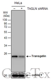 Anti-Transgelin antibody [GT4511] used in Western Blot (WB). GTX629078