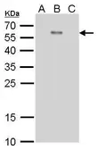 Anti-Dengue virus Envelope protein antibody [GT214] used in Western Blot (WB). GTX629116
