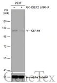 Anti-GEF-H1 antibody [GT336] used in Western Blot (WB). GTX629398