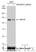 Anti-GEF-H1 antibody [GT1132] used in Western Blot (WB). GTX629399