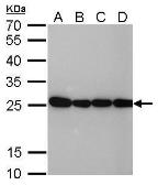 Anti-HMGB1 antibody [GT412] used in Western Blot (WB). GTX629400