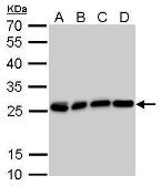 Anti-HMGB1 antibody [GT349] used in Western Blot (WB). GTX629403