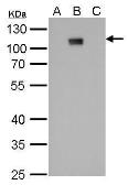 Anti-Dengue virus Type 2 NS5 protein antibody [GT353] used in Western Blot (WB). GTX629446