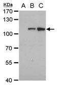 Anti-Dengue virus NS5 protein antibody [GT353] used in Western Blot (WB). GTX629446