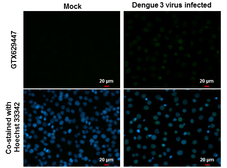 Anti-Dengue virus NS5 protein antibody [GT361] used in Immunocytochemistry/ Immunofluorescence (ICC/IF). GTX629447