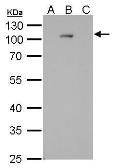 Anti-Dengue virus Type 2 NS5 protein antibody [GT361] used in Western Blot (WB). GTX629447