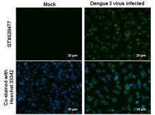 Anti-Dengue virus NS3 protein antibody [GT2811] used in Immunocytochemistry/ Immunofluorescence (ICC/IF). GTX629477
