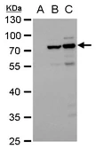 Anti-Dengue virus NS3 protein antibody [GT2811] used in Western Blot (WB). GTX629477