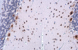 Anti-HMGA2 antibody [GT763] used in IHC (Paraffin sections) (IHC-P). GTX629478