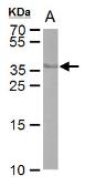 Anti-Cre recombinase antibody [GT10212] used in Western Blot (WB). GTX629479