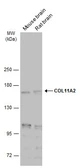 Anti-COL11A2 antibody [GT212] used in Western Blot (WB). GTX629481