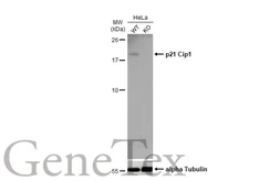 Anti-p21 Cip1 antibody [GT1032] used in Western Blot (WB). GTX629543