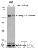 Anti-Fatty Acid Synthase antibody [GT237] used in Western Blot (WB). GTX629628