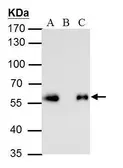 Anti-DDDDK tag antibody [GT231] used in Immunoprecipitation (IP). GTX629631