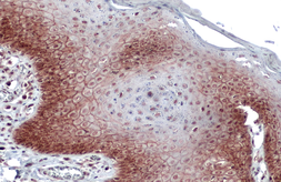 Anti-E-Cadherin antibody [GT477] used in IHC (Paraffin sections) (IHC-P). GTX629691
