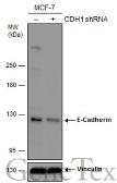 Anti-E-Cadherin antibody [GT311] used in Western Blot (WB). GTX629692