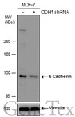 Anti-E-Cadherin antibody [GT311] used in Western Blot (WB). GTX629692