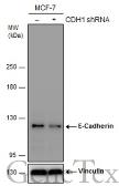 Anti-E-Cadherin antibody [GT358] used in Western Blot (WB). GTX629694