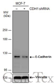 Anti-E-Cadherin antibody [GT358] used in Western Blot (WB). GTX629694