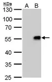 Anti-Influenza A virus H1N1 NA (Neuraminidase) antibody [GT288] used in Western Blot (WB). GTX629696