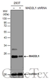 Anti-MAD2L1 antibody [GT1761] used in Western Blot (WB). GTX629697