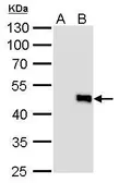 Anti-IL28B antibody [GT727] used in Western Blot (WB). GTX629699