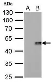 Anti-IL28B antibody [GT617] used in Western Blot (WB). GTX629700
