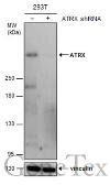 Anti-ATRX antibody [GT4212] used in Western Blot (WB). GTX629703