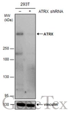Anti-ATRX antibody [GT4212] used in Western Blot (WB). GTX629703