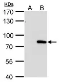 Anti-MX1 antibody [GT4812] used in Western Blot (WB). GTX629738
