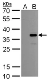 Anti-COL11A2 antibody [GT6410] used in Western Blot (WB). GTX629739