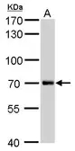 Anti-UVSSA antibody [GT816] used in Western Blot (WB). GTX629742