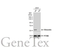 Anti-Vimentin antibody [GT7812] used in Western Blot (WB). GTX629743