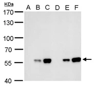 Anti-Carbonic Anhydrase IX antibody [GT14212] used in Western Blot (WB). GTX629747