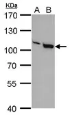 Anti-VAV1 antibody [GT557] used in Western Blot (WB). GTX629749