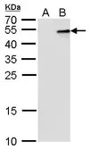 Anti-IL28B antibody [GT2512] used in Western Blot (WB). GTX629760