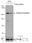 Anti-Fatty Acid Synthase antibody [GT5210] used in Western Blot (WB). GTX629761