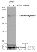 Anti-Fatty Acid Synthase antibody [GT556] used in Western Blot (WB). GTX629762